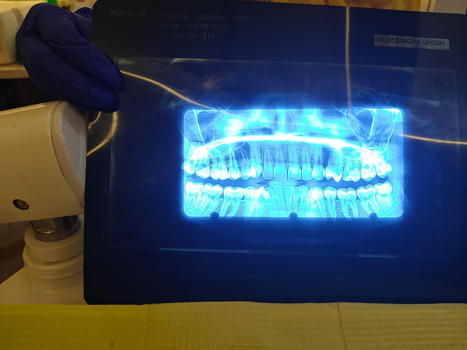 Panoramic X-Ray Diagnosis
